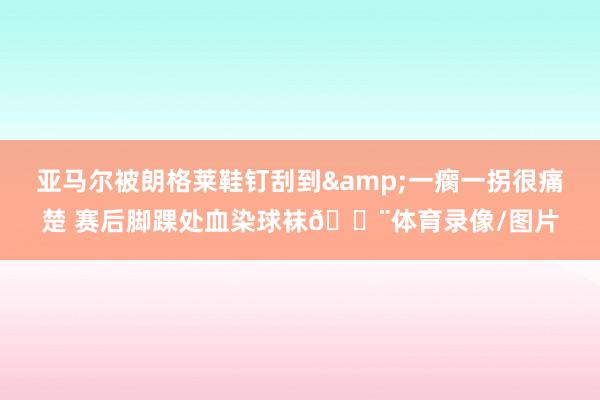 亚马尔被朗格莱鞋钉刮到&一瘸一拐很痛楚 赛后脚踝处血染球袜😨体育录像/图片